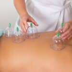 cupping therapy for pain relief a comprehensive guide