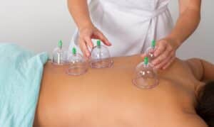 cupping therapy for pain relief a comprehensive guide